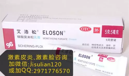 艾洛松软膏能用在脸上吗？可以用来治疗激素依赖性皮炎吗？